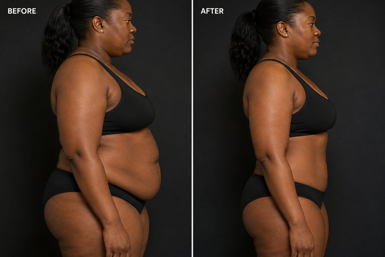 Body contouring consultation